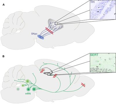 Early Degeneration of Both Dopaminergic and Serotonergic Axons – A Common Mechanism in Parkinson’s Disease